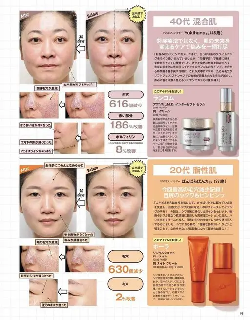 VOCE 2026年12月号 After
法令纹变淡了
脸部轮廓更清爽
嘴角下方的阴影变淡了